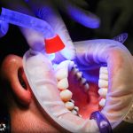 ce nu ai voie sa faci dupa implant dentar